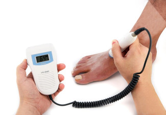 bistos bt 200 vascular doppler v2